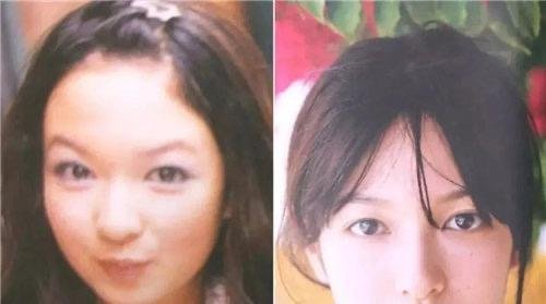 日本整容技术到底有多牛?