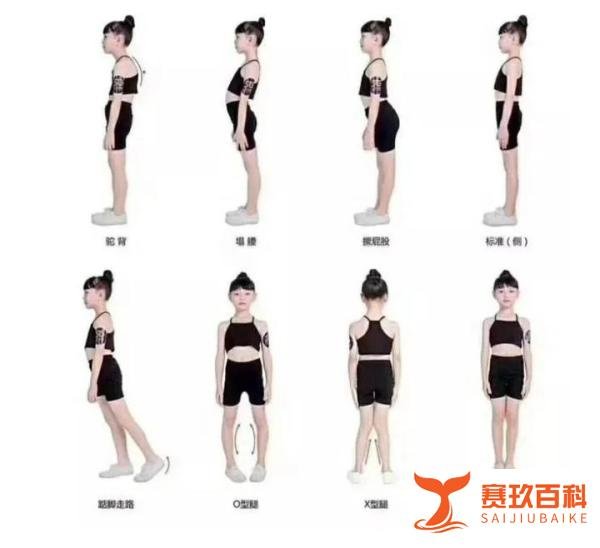 o型脚和x型腿的区别67072-文坚体态研究