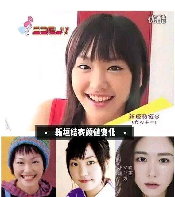 日本整容技术到底有多牛?