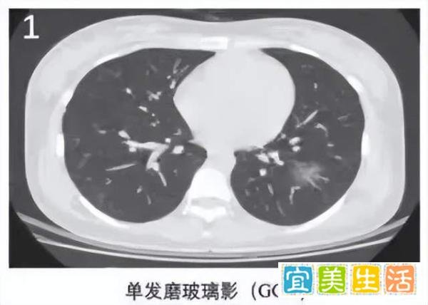 全网热搜!家庭抢囤呼吸制氧机,到底有多重要?