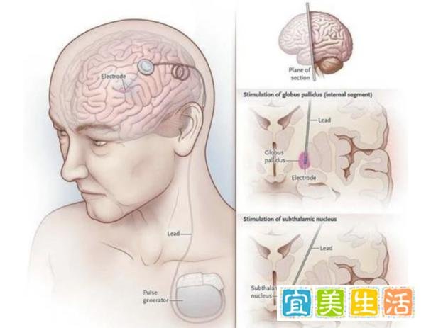 精神问题导致丧失行动能力?初三男孩被批评后患“怪病”,腿疼不能走路!