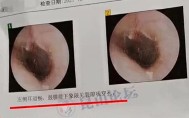 昆山宝马车主未给女司机让路，狂扇女司机丈夫耳光，如何看待此事？