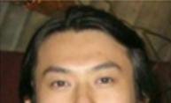 上海眼部整形医生推荐【眼综合、开眼角、双眼皮修复、眼角修复等】