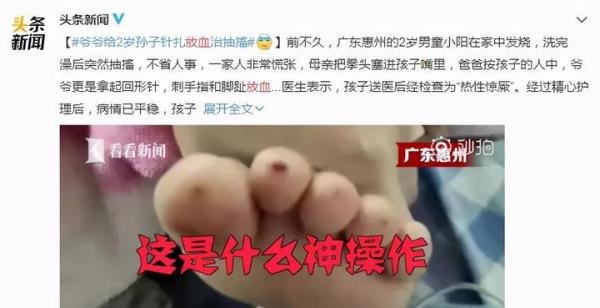 爷爷给孙子放血治抽搐，差点害了娃：家庭易踩误区，千万要重视