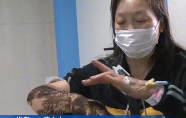 江边散步被蛇咬,女子被送到医院,医生看伤口后惊呼:你命真大