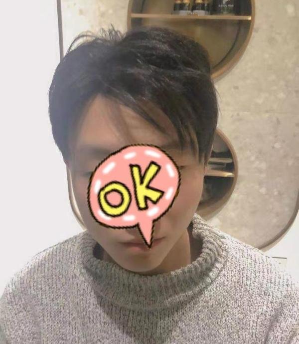 第一批00后开始脱发了，你的发际线没事吧？