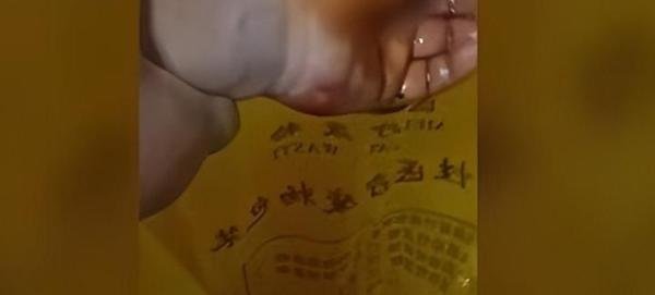 男子被恶狗咬伤后徒手将狗掐死 网友:正当防卫