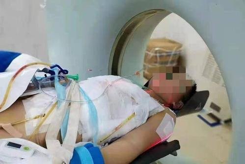 湖南村医9岁儿子遭患者捅50多刀,性格极端的人有哪些特征?