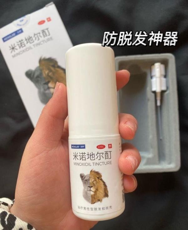 大家有用过米诺地尔的吗？蔓狮和达霏欣哪个好用？