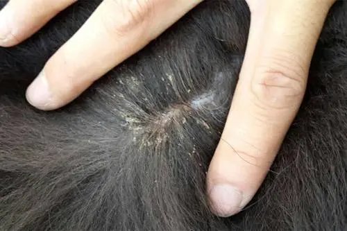 东莞一女儿被妈妈用农药焗头驱虱进ICU,她女儿究竟怎么了?