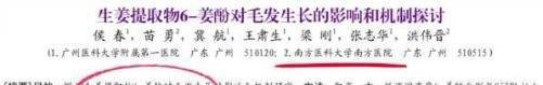 我做发际线种植1500个毛囊,术后两年效果图及真实植发经历分享!植发际线的四大误区及避雷点,一文说清
