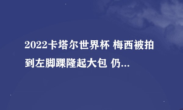 2022卡塔尔世界杯 梅西被拍到左脚踝隆起大包 仍将出战沙特
