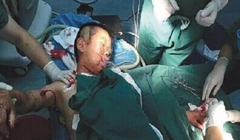 湖南村医9岁儿子遭患者捅50多刀,性格极端的人有哪些特征?