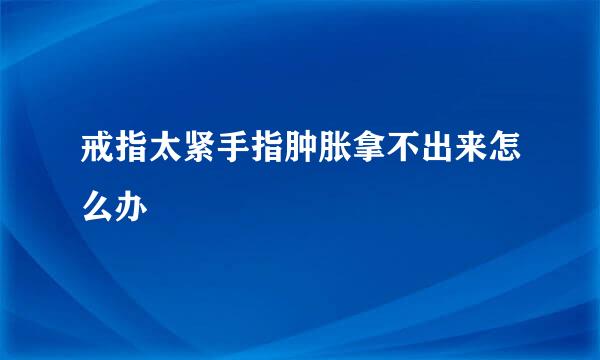 戒指太紧手指肿胀拿不出来怎么办