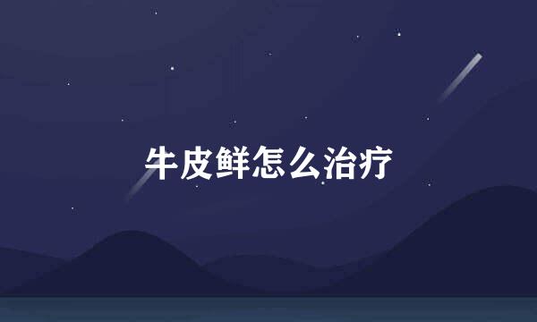 牛皮鲜怎么治疗