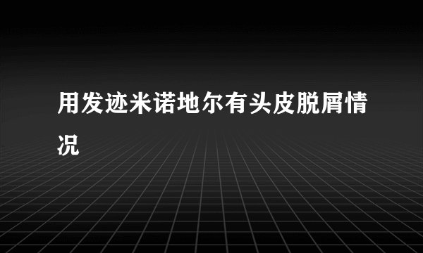 用发迹米诺地尔有头皮脱屑情况