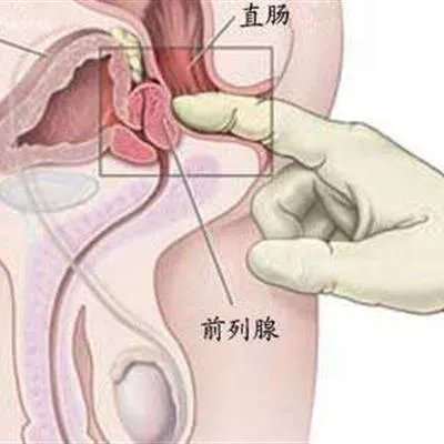 大阴茎是靠“练”出来的