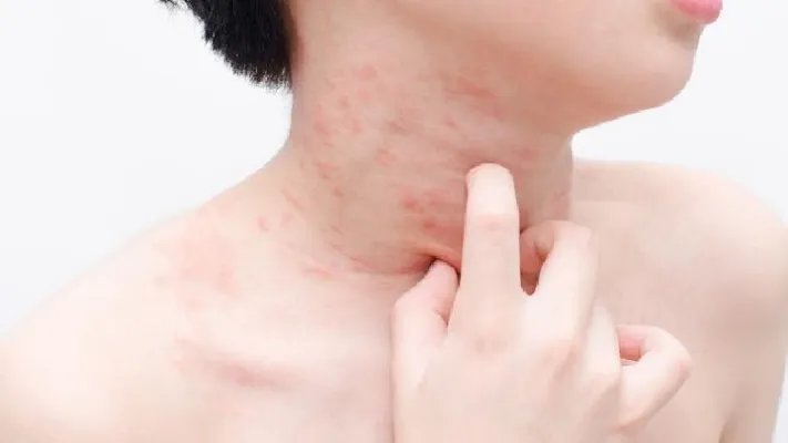 治疗红斑狼疮医院如何选择