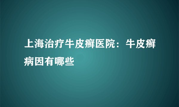 上海治疗牛皮癣医院：牛皮癣病因有哪些