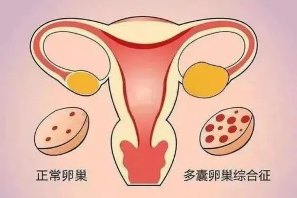 郑州怀八胞胎女子仅18岁,事件的背后有何隐情?
