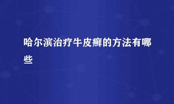 哈尔滨治疗牛皮癣的方法有哪些