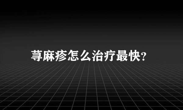 荨麻疹怎么治疗最快？