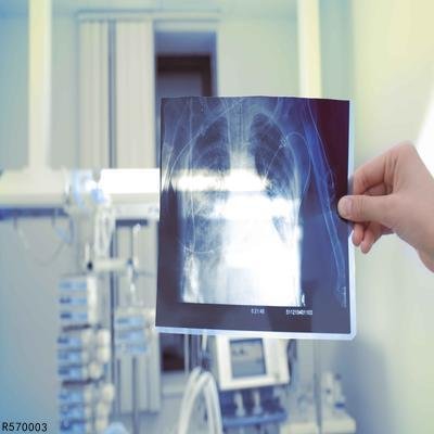 做漏斗胸手术要多少钱 揭晓影响漏斗胸手术费用四个方面