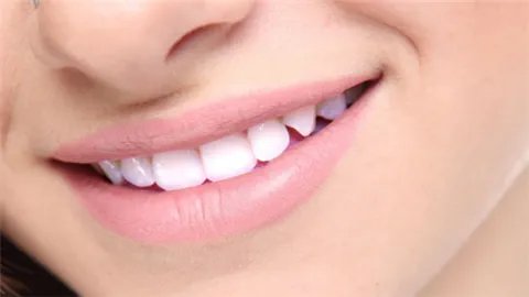 湛江牙齿不齐整形新版价格清单新鲜出炉_牙齿矫正大概需要多少钱