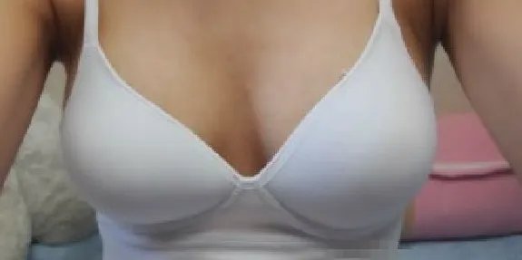 深圳假体丰胸医院哪里好？