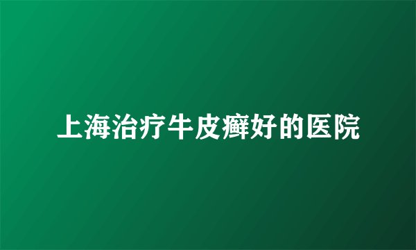 上海治疗牛皮癣好的医院