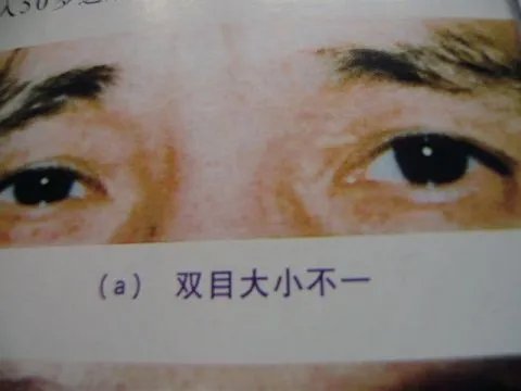 瑶医目诊图-望面诊病图解-目诊