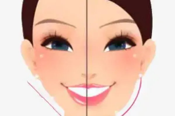 暑假现青少年“整容热”!整容真能“早做早变美”?