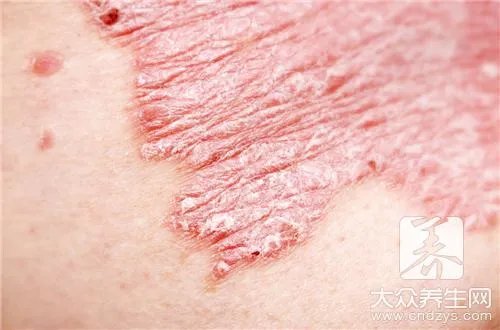 何首乌的功效与作用及食用方法有哪些?