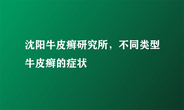 沈阳牛皮癣研究所,不同类型牛皮癣的症状