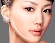 瘦脸针多少钱