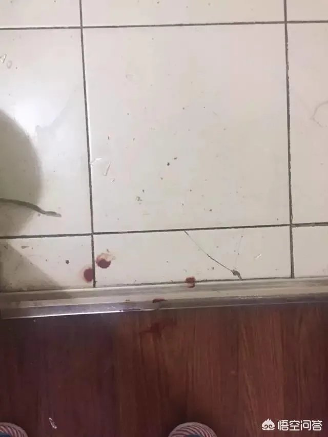 宜家水杯自爆崩断门牙,女子要求宜家赔偿百万,你们认为法院会支持吗?