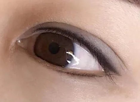 眼部整形手术费用要多少