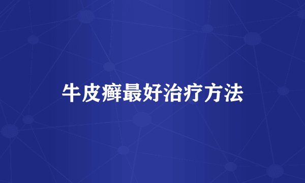 牛皮癣最好治疗方法