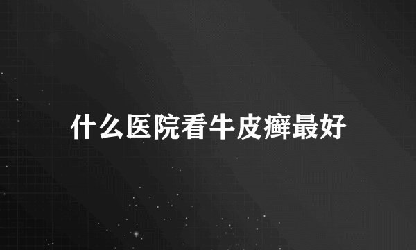 什么医院看牛皮癣最好