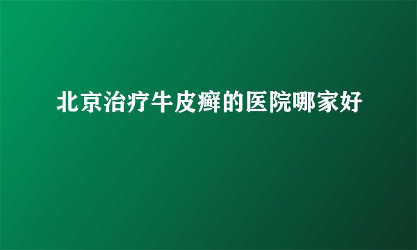 北京治疗牛皮癣的医院哪家好