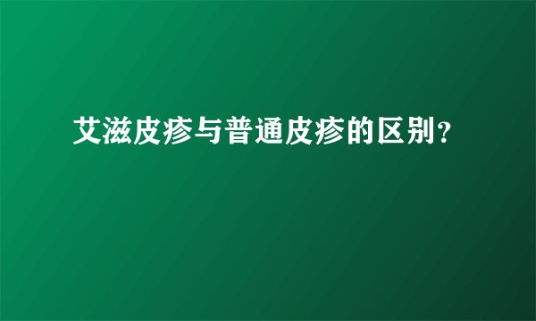 艾滋皮疹与普通皮疹的区别？