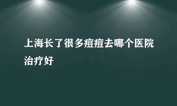 上海长了很多痘痘去哪个医院治疗好