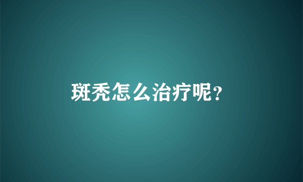 斑秃怎么治疗呢?