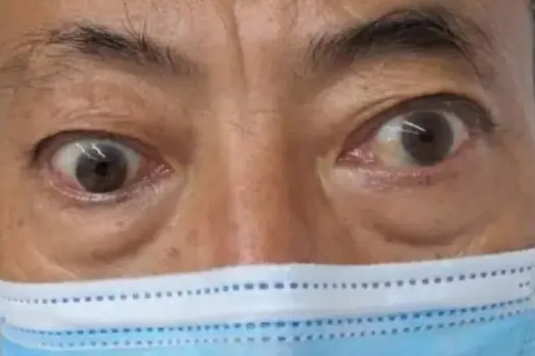 甲亢是什么样的病，严重吗