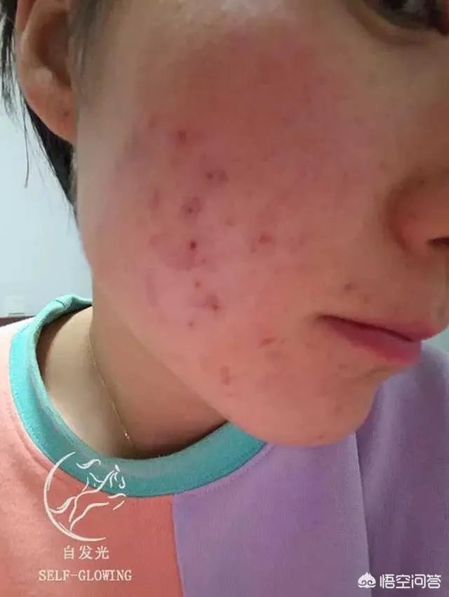 女生为了变好看变漂亮能有多拼?