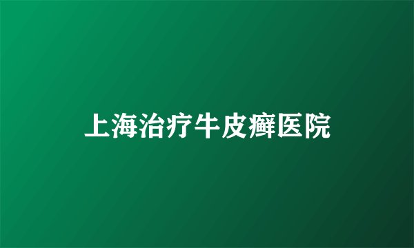 上海治疗牛皮癣医院