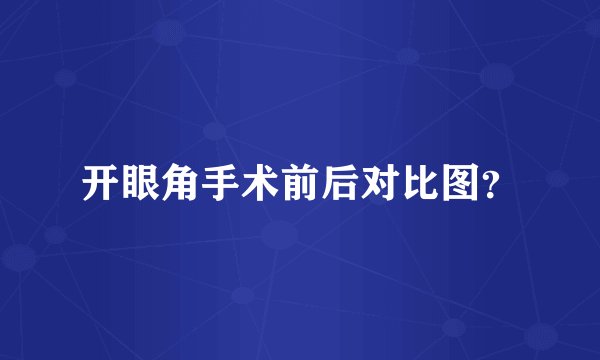 开眼角手术前后对比图？