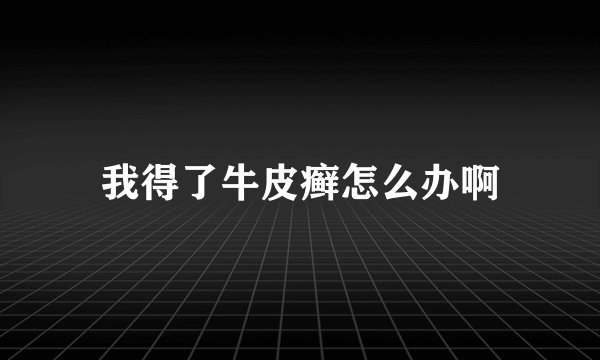 我得了牛皮癣怎么办啊
