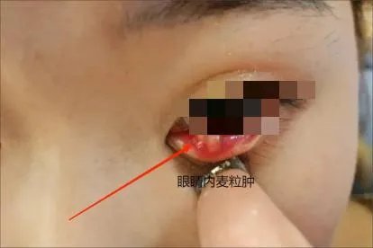 相关推荐
