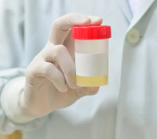 感冒药也能吃死人?专家提醒:安全用药避免肾损伤,需要注意这4点
